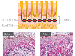 Wound Healing Mechanisms (WHM)